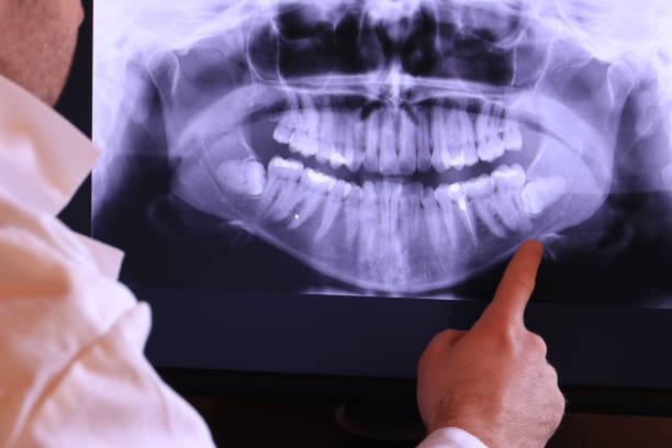 Best Same-Day Emergency Dentist in Mount Vernon, MD